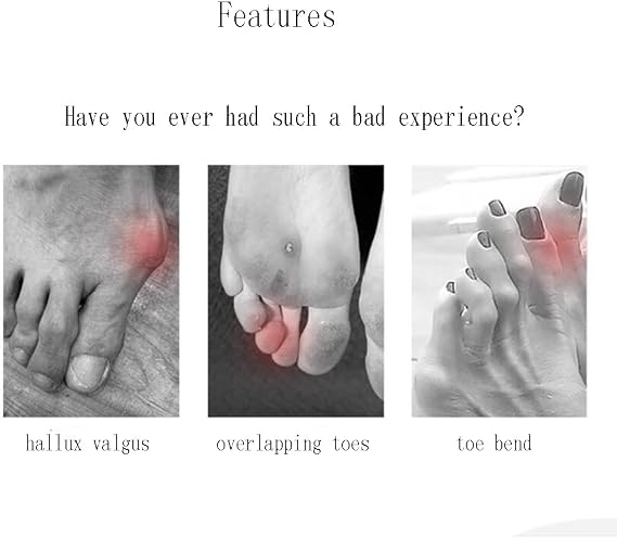 Blue Three-Hole Splitter, Hallux Valgus Corrector, Heavy Overlapped Big Foot Bone Orthosisrepeatable Washable Toenail Dividers