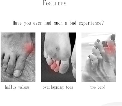 Blue Three-Hole Splitter, Hallux Valgus Corrector, Heavy Overlapped Big Foot Bone Orthosisrepeatable Washable Toenail Dividers