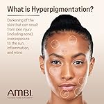 Ambi Even & Clear Advanced Fade Cream, Hydroquinone-free, Hyperpigmentation Treatment, Stubborn Dark Spot Corrector, Results In As Little As 2-3 Weeks, Niacinamide, Licorice Root Extract, PHA, 1 Fl Oz - Image 3