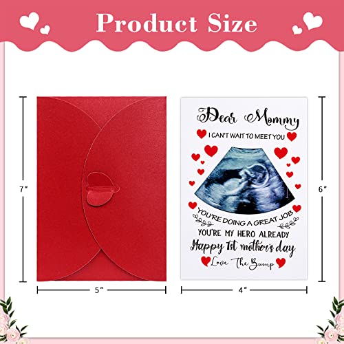 Sichome Funny First Mothers Day Card For Mom 4"X6" Happy 1St Mother's Day Card With Photo Insert Mom To Be Mothers Day Gifts Cards For First Time Mom Pregnant Mom Mother To Be New Mom Mommy #TOP6