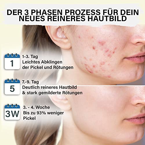 Zinksalbe Hochdosiert + Teebaumöl + Salicylsäure+Lavendelöl | 50 ml | Zinkcreme gegen Pickel und unreine Haut | Satisa
