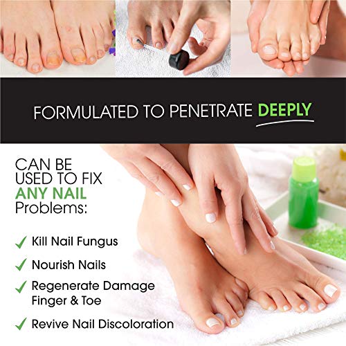 All Natural Nail Fungus Treatment – Made in USA, Best Nail Repair Product, Stop Fungal Growth, Effective Fingernail & Toenail Solution, Fix & Renew Damaged, Broken, Cracked & Discolored Nails