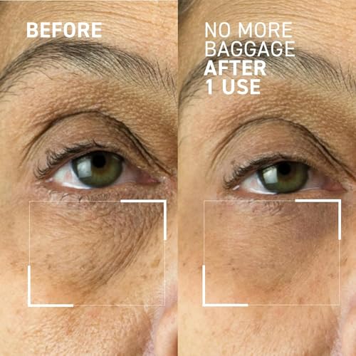 Dr. Brandt Needles No More, No More Baggage Bundle - Minimizes Under-Eye Bags, Puffiness & Dark Circles - Full (0.5 oz) + Travel Size (0.25 oz) - Thumbnail 2