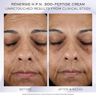Lancome Renergie H.C.F. Triple Serum Discovery Set