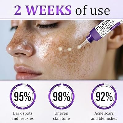 PigmentaX ProFade Cream Hyperpigmentation Treatment for Even Skin Tone (4PCS)