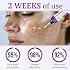 PigmentaX ProFade Cream Hyperpigmentation Treatment for Even Skin Tone (4PCS)