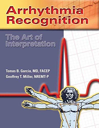 Image of [(Arrhythmia Recognition: The Art of Interpretation)] [Author: Tomas B. Garcia] published on (November, 2003)