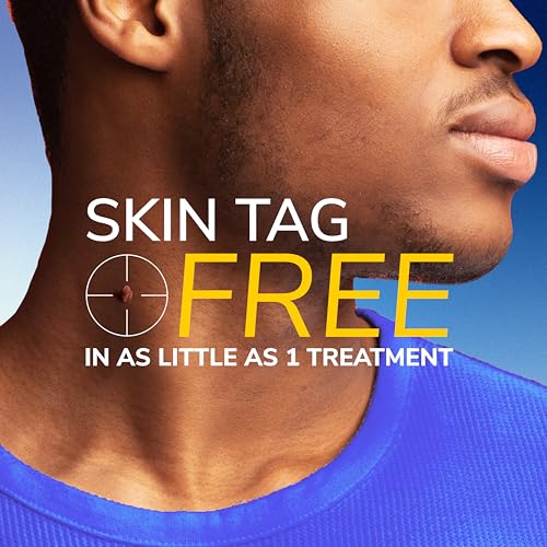 dr scholl39s freeze away skin tag remover kit 8 ct  completely removes skin tags in as little as 1 treatment fda-cleared amp clinically proven at-home removal easy 1-handed action permanent results