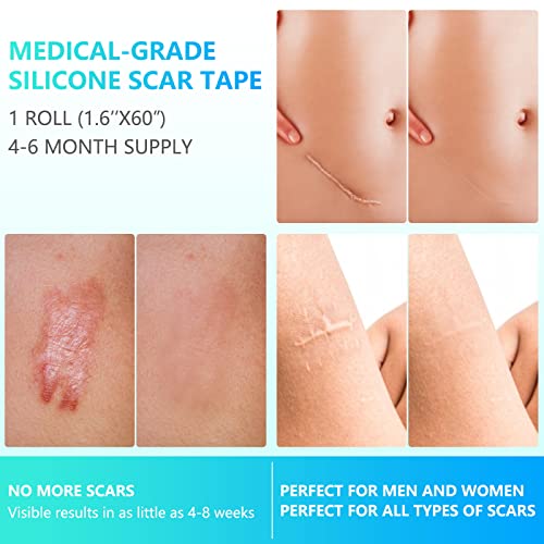 Silicone Scar Sheets, Silicone Scar Tape 1.6" X 60", Reusable And Effective Scars Strips Removal Treatment For Scars Caused By C- Section, Burn Scars, Surgery, Acne #TOP5