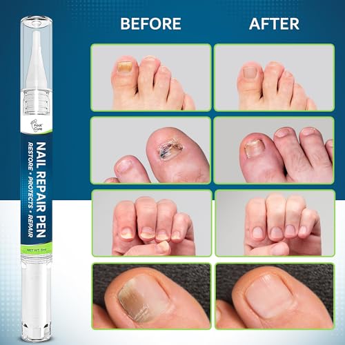 image for Footcure Antifungal Nail Treatment Pen – Extra Strength Toenail Fung