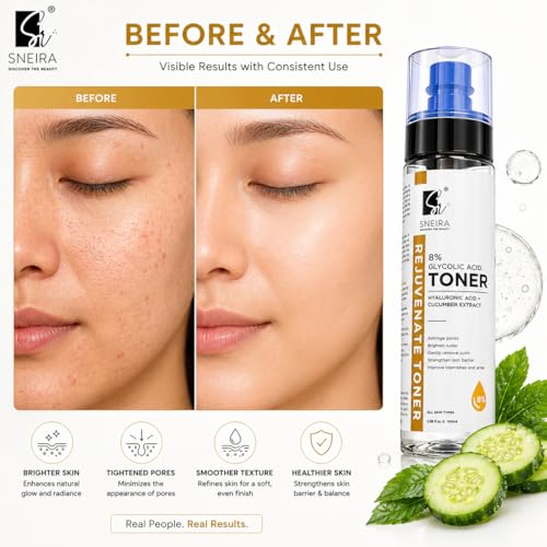 Image of 8% Glycolic Acid Toner 400 ml, Hydrating Face Mist Toner Enriched with Hyaluronic Acid & Cucumber Extract For Exfoliating Glowing Skin, Pores Tightening, Korean Beauty Secrets For Women & Men