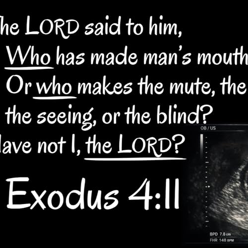 Exodus 4:1-17 | God's Presence > Moses' Excuses, Part 2
