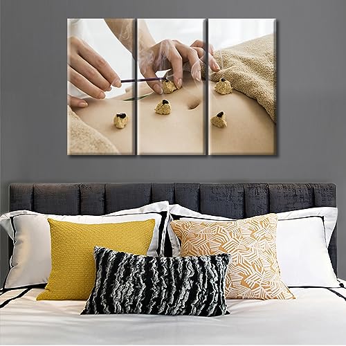 Image of Moxa Moxibustion Prints for Wall Decor Moxibustion Framed Wall Art Posters & Prints 3 Panels Nosocomium Paintings Giclee Print Gallery Packaging Artwork (36 inch Wx24 H)