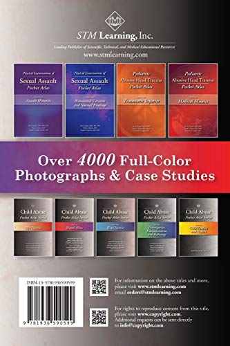 Child Abuse Pocket Atlas, Volume 2: Sexual Abuse