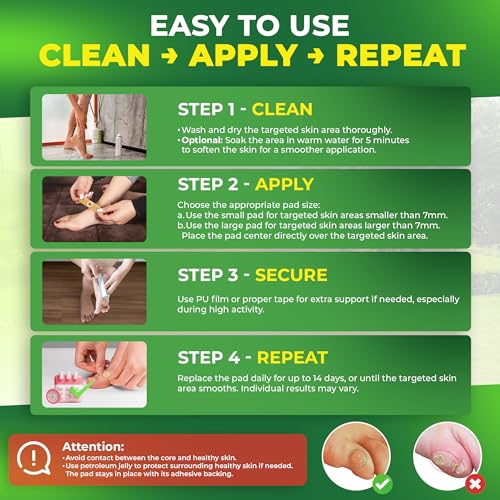 Image of Ulensy Corn Remover Pads for Feet Toes: 30-Pack Salicylic Acid Extra Strength Treatment - Fast Effective Medicated Bandages for Kids Adults Seniors Teens Athletes Runners Hikers Workers Men Women