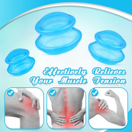 Image of TrelaCo 6 Pcs Silicone Cupping Kit for Massage Therapy,Clear Blue | Cupping Cups 3 Sizes, Suction Therapy for Body Massage Myofascial, Relieves Cellulite Muscle Pain Tension, Studio Household