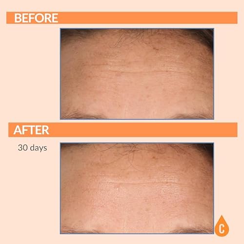 Miniatura 5 de Serious Skincare Suero de vitamina C para cara, suero facial antienvejecimiento con colágeno, vitamina E, cuidado hidratante de la piel para