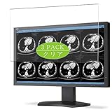 multisync ea244wmi review El material es suave, flexible, protege su pantalla de rasguños y rasguños diarios.