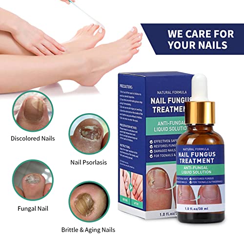 Nail Fungus Treatment, Toenail Fungus Treatment, Nail Repair Use At Home (1 Pcs) #TOP3