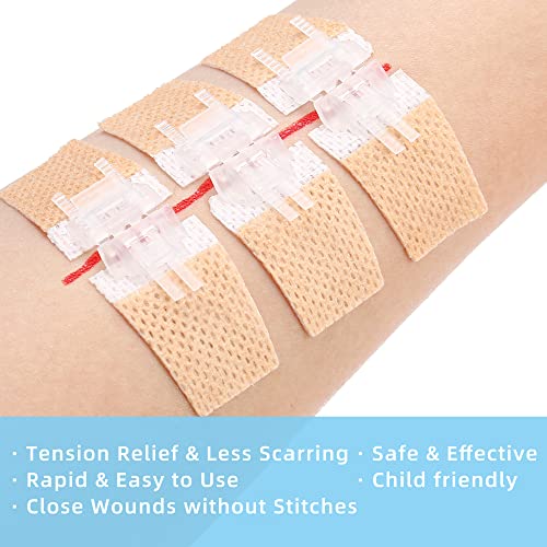 Lotfancy Emergency Laceration Closures, Medical First Aid Supplies, 4-Count, Butterfly Bandaids, Wound Care Surgical Sutures Strips Kit With Accessories, Sterile, Latex-Free #TOP2