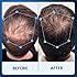 Hair Regrowth Serum for Thinning Hair, 30ml Clinically Backed Peptides, Biotin, Ginseng & Scutellaria Supports Hair Growth, Strengthens Roots, and Promotes Healthier Scalp