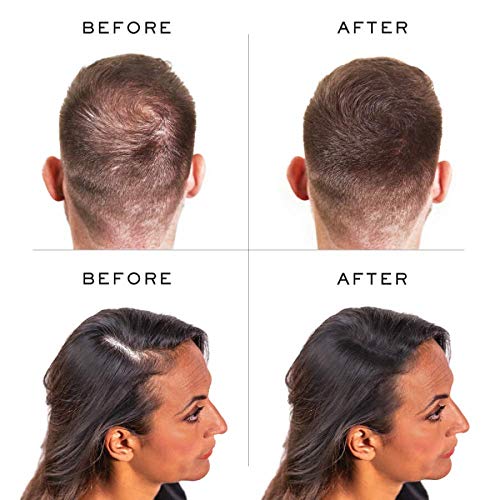 Image of Nanogen Keratin Hair Thickening Fibers 30 gm (Grey)