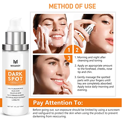 Dark Spot Corrector For Face And Body Serum, Dark Spot Remover For Women And Men, Treatment For Hyperpigmentation, Age Spot, Melasma, Brown Spots And Other Stubborn Spots #TOP4