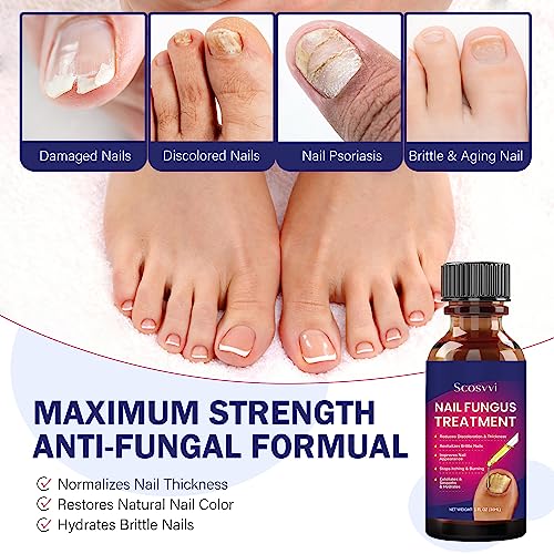 ToeNail Fungus Treatment Extra Strength, Nail Fungus Treatment for Toenail, Fungus Nail Treatment, Toenail Fungus Treatment, Antifungal nail treatment for Athletes Foot, Thick Nails - Thumbnail 3