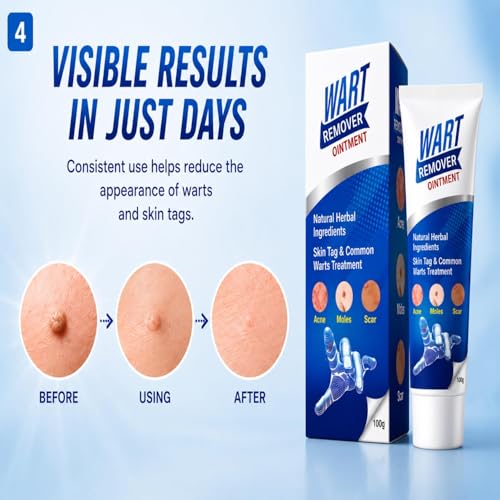 Image of Wart Remover Ointment, wart removal cream for face Wart Removal | Massa Remover Ointment For Skin | Skin Tag Remover Cream | wart remover ointment cream | 100Gm Pack of 1