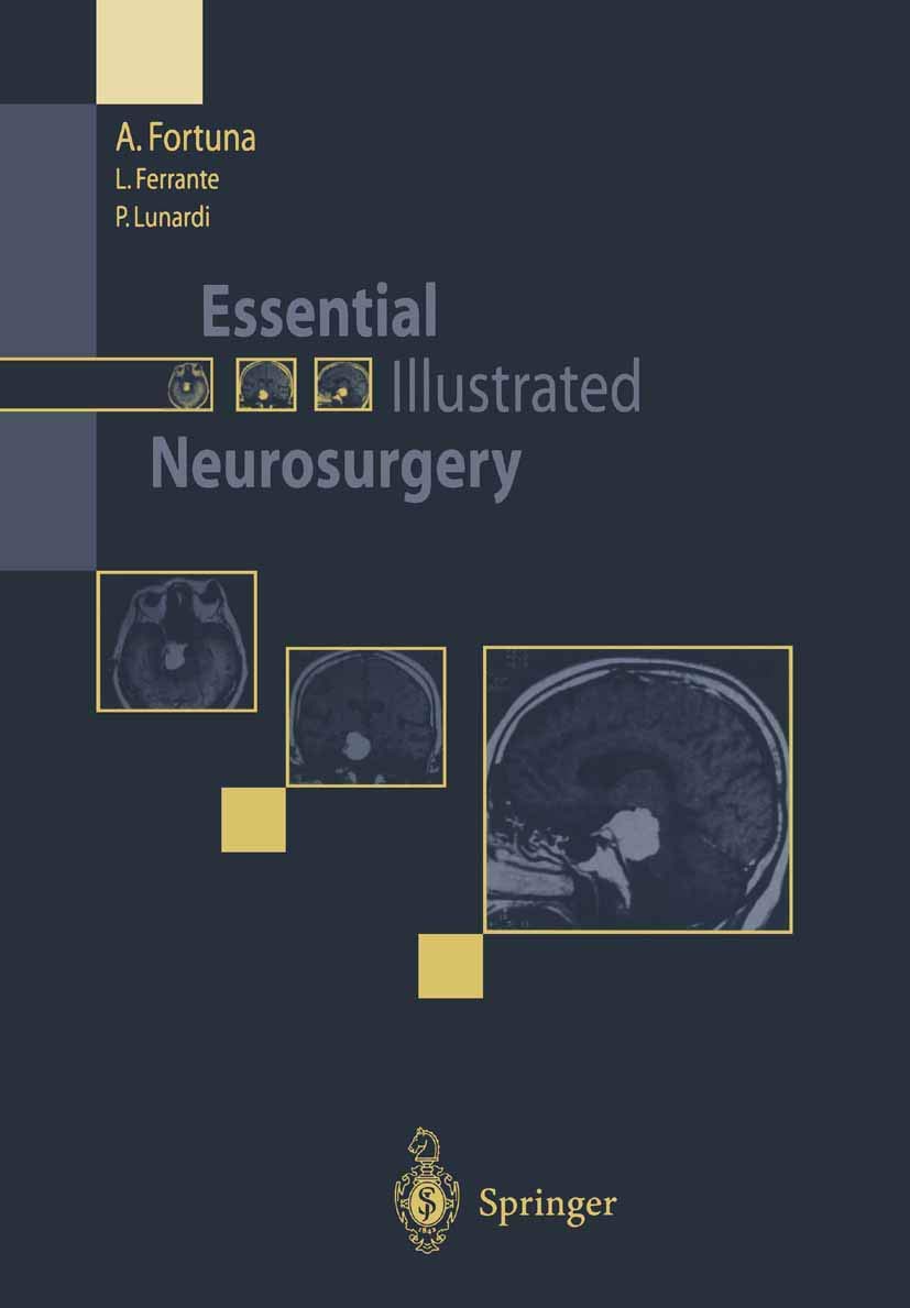 Buy Essential Illustrated Neurosurgery — BookShops.in