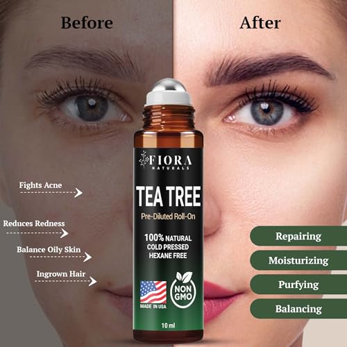 Image of Fiora Naturals Tea Tree Oil Roll On - 100% Natural Tea Tree Essential Oil for Skin, Face, Acne, Nails, Cuticles, Scalp & Aromatherapy Wellness