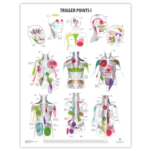 Anatomy Lab Trigger Points I Poster, LAMINATED, Anatomy and Physiology Trigger Points Poster, 17.3 x 22.5 Inches, Trigger Points Anatomy Poster