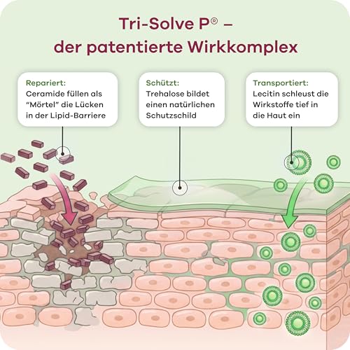 Heposan – Hämorrhoiden Gel – Bei Hämorrhoiden, Analfissuren & Proktitis – lindert Juckreiz, Brennen & Schmerzen – Medizinprodukt – 10 Einwegtuben à 3,5 g