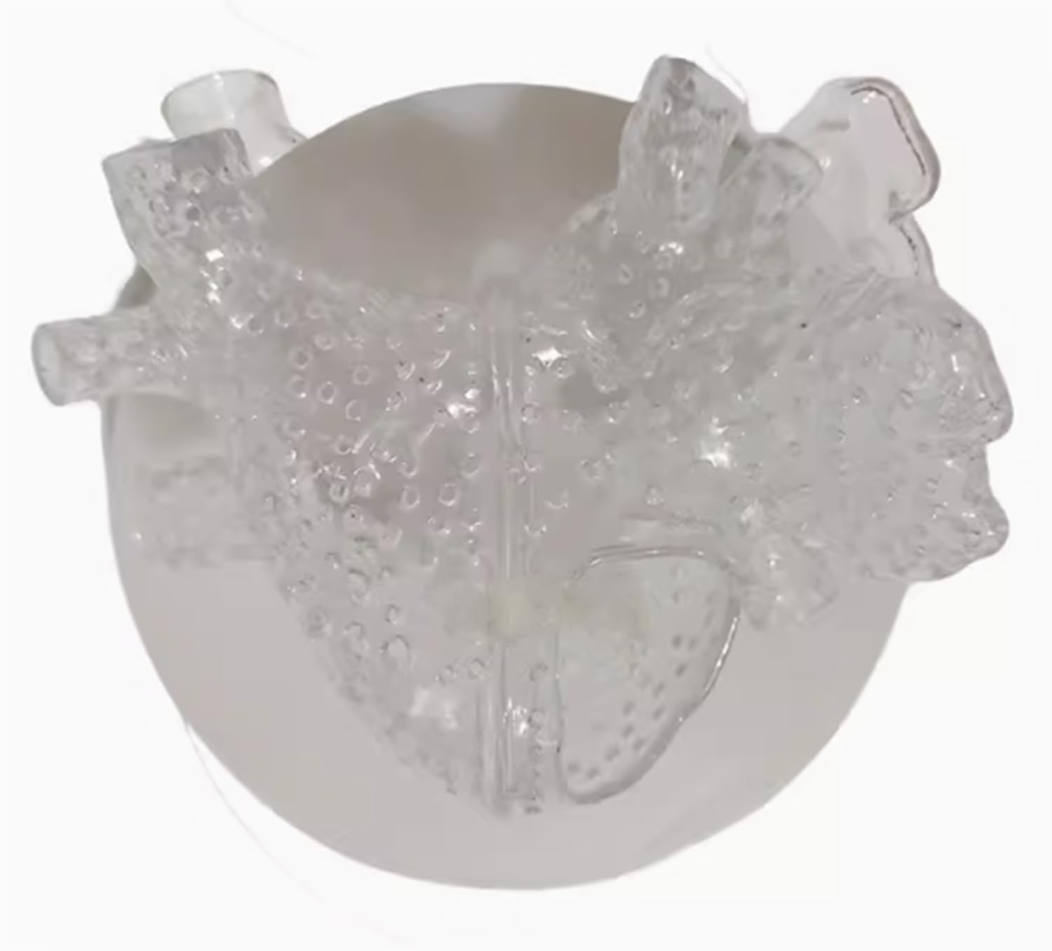 Pratique EP multi-trous via IVC avec le modèle d'atrium gauche AMITD à échelle 1:1