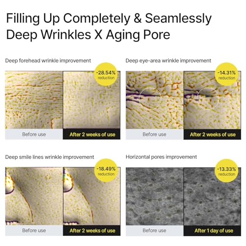 Image of Vita-A Retinal Shot Tightening Booster with 0.1% Retinal, Matrixyl & Niacinamide | Pore Minimizer, Wrinkles & Fine Lines, Firmer Skin, Korean Face Serum (15ml)