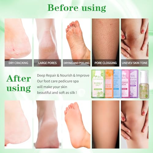 nbc BeautiLab Pedicure Foot Soak Set - Upgraded 6 in 1 Foot Spa, Foot Bath Spa, Pedicure Kit, Foot Soak for Tired & Dry Cracked Feet, Athletes Feet, Bad Odor, Softens Calluses (Jasmine)