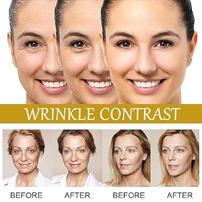 Advanced Bee Venom Serum, Anti-Aging Facial Serum, Face Serum to Help Refine Fine Lines & Wrinkles, Hydrating facial essence