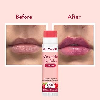 WishCare Tinted Lip Balm with SPF 50 PA+++ | Brightening Lip Balm for Dark Lips | Kojic Acid & Niacinamide | For Women | 5g