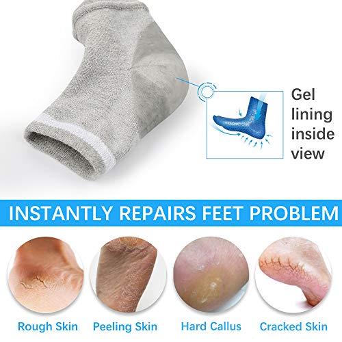 Moisturizing Socks, Moisturizing/Gel Heel Socks For Dry Cracked Heels, Open Toe Socks, Ventilate Gel Spa Socks To Heal And Treat Dry, Gel Lining Infused With Vitamins-3 Pairs(Pink, Turquoise, Grey) #TOP3