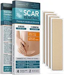 Folhas, tiras e fitas para cicatrizes de silicone - Queloide, cesariana, cirúrgica - Tratamento para remoção de cicatrizes - Bandagem de creme de gel de silicone - Cirurgia de abdominoplastia - 4 pa