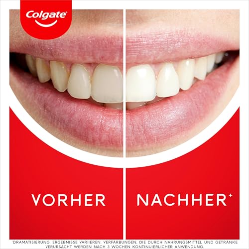 Colgate Zahnpasta Max White Ultra Active Foam 2x75ml - Weißere Zähne in 3 Tagen – Bild 4