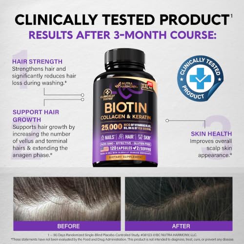 Image of Biotin, Collagen, Hyaluronic Acid & Keratin - Hair Growth Support, 120 Caps