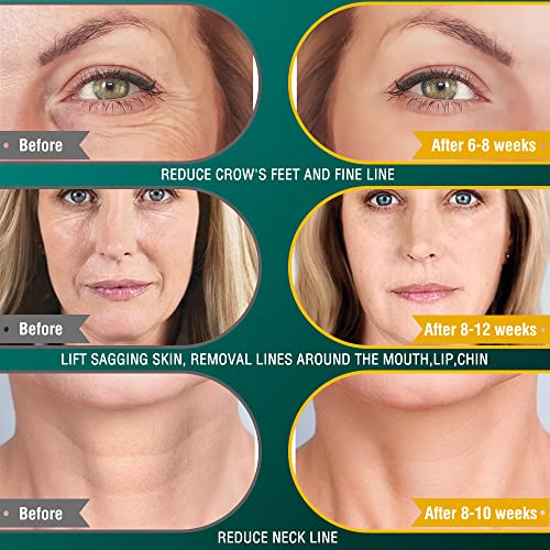 RF Radio Frequency Machine | Anti Aging | Skin Care | Portable Handheld RF Machine for Facial Neck Arm Waist Buttocks Legs (Stylish, Multi) - Thumbnail 4