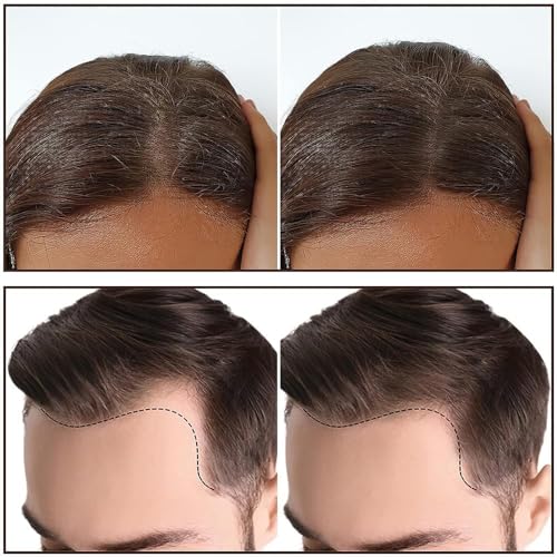 Image of Instant Natural Hairline Colour Touch-Up Powder for Women & Men, Natural Shadow Filler & Shading Sponge Pen for Thinning Hair, Quick Root Touch-Up & Hairline Concealer (BLACK HAIR STICK POWDER)