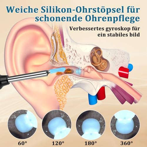 Ohrenschmalz Entferner Otoskop, LMECHN 1080P HD ohrenreiniger, Ohrreiniger mit 6 LEDs, Reinigung für iPhone, Android, iPad, Schwarz