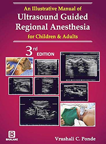 AN ILLUSTRATIVE MANUAL OF ULTRASOUND GUIDED REGIONAL ANESTHESIA FOR CHILDREN AND ADULTS [Paperback Bunko] VRUSHALI PONDE
