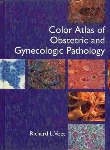 Color Atlas Of Obstetric And Gynecologic Pathology: 9780815190486 ...