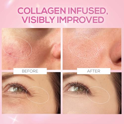 Image of RENEE Pink Therapy Hydrolyzed Collagen Overnight Sleep Jelly Mask | Hydrates, Repairs, Smoothens & Plumps Skin | Peptides, Niacinamide & Hydrolyzed Collagen Enriched | 50 gm