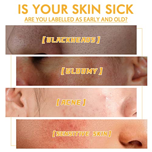 Jiskg Honey Tearing Mask,Honey Peel Mask For Face Oil Control Blackhead Remover Off Dead Skin Clean Pores Shrink (1 Pcs) #TOP6