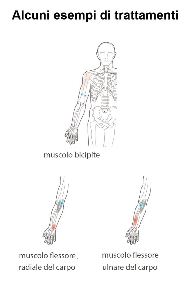 Ultrasuoni portatile terapie antidolorifiche massaggi con ultrasuonoterapia per il benessere di tutto il corpo con gel Arnica